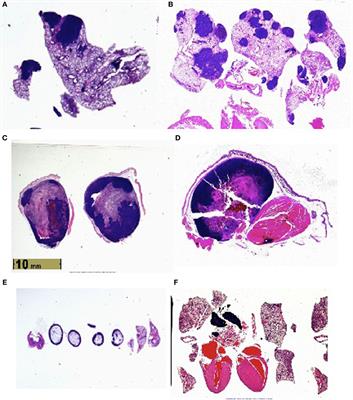 Enhanced Mortality to Metastatic Bladder Cancer Cell Line MB49 in Vasoactive Intestinal Peptide Gene Knockout Mice